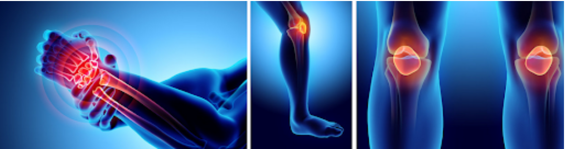 Суглобовий біль